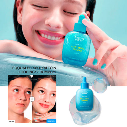 PREVENTA - EQQUALBERRY HYALTOIN FLOODING SERUM 30ml