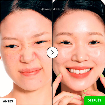 PREVENTA - Eqqualberry Aloe PDRN Calming Serum 30ml