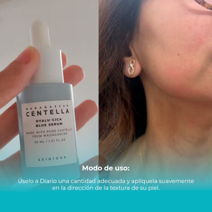 PREVENTA! SKIN1004 - Madagascar Centella Hyalu-Cica Blue Serum - 30ml