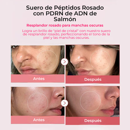 Medicube PDRN Pink Peptide Serum – Hidratación y Elasticidad Facial 30ml